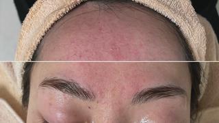 ビフォーアフター 