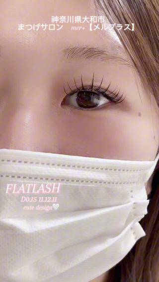 FLATLASH 160本 D 11.12.11