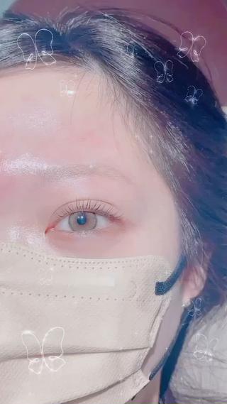 大人気メーテルロット 