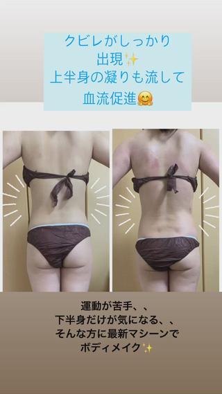 運動が嫌いなそこのあなた
血流改善もしながら
セルライトも潰して綺麗な
ボディを手に入れましょう
お正月はすぐそこ、、、