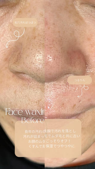 産毛や毛穴に詰まった汚れ、皮脂、古くなった角質も一緒にオフ!ツルツル艶々のお肌になりますよ