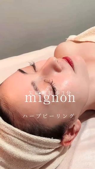 小顔サロンだからこそ、
ハーブの入れ込み方や施術の流れの中に
むくみを最大限に取る手法を加えています♡
美肌はもちろん、
すっきり小顔も手に入るのは
mignonのハーブピーリングだけです