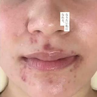 インスタに症例写真たくさんアップ中