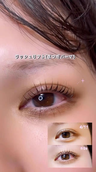 ラッシュリフト

7月から毎日欠かさず美容液とコーティング剤を塗ってくれたので、4月の初めて来て下さった時から今回の最近のまつ毛の伸び方太さが一目瞭然です
ラッシュアディクトは即効性があるので、やる気もモチベも保ったまま太く強くなります 