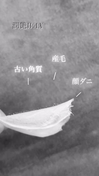 美白/韓国肌管理 💎 KOTOMIのエステ・リラクイメージ