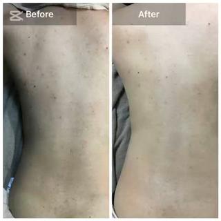 ハーブピーリング専門 MOKAのエステ・リラクイメージ
