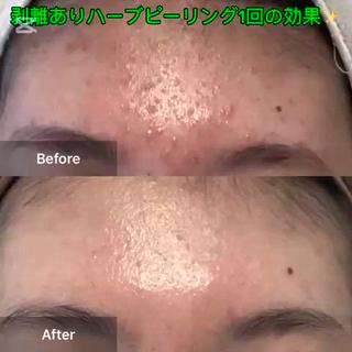 ハーブピーリング専門 MOKAのエステ・リラクイメージ
