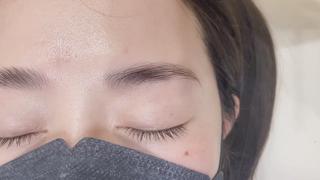 HBLで下がり眉、困り眉改善♪♪
