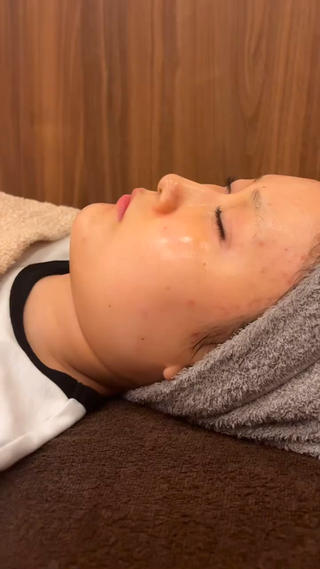 2回目のお客様

美容鍼×ララピールでWアプローチ！！
筋肉の硬さをとりながら、お肌に栄養を

毛穴ケアしたい！という方にはララピールをオススメしています！ 