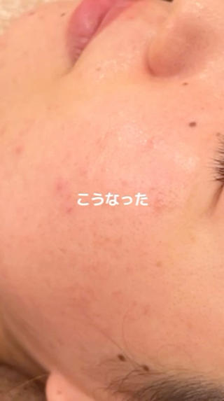 chika🦋 ハリラウンジ恵比寿のエステ・リラクイメージ