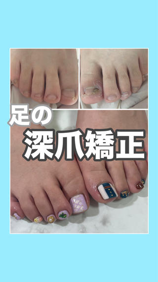 ※追加アート料金別途頂戴しております。