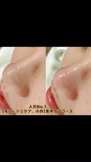 毛穴ゼロ、シミ、くすみゼロ、ツルツル卵肌へ 