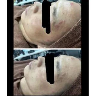 プレイス天王寺店 【肌質改善/ハーブ】のエステ・リラクイメージ