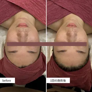 シミ・毛穴ケア専門 クロヌYUKIのエステ・リラクイメージ