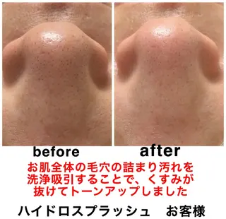 ネイル・エステサロン UILANIのネイルデザイン