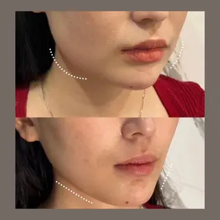 愛維美水光美肌専門店所属・愛維美水光美肌専門店 メンズレディースokのエステ・リラクイメージ