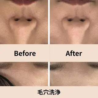 【小顔・毛穴ケア】 セラピスト　和田紋子のエステ・リラクイメージ