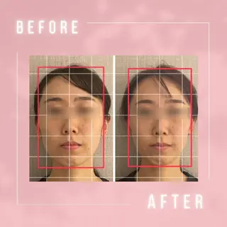 小顔・肌悩み専門店 ボーテドリッシュのエステ・リラクイメージ