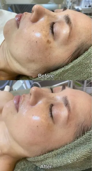 ROOM.S ｜脱毛｜美肌｜ボディのエステ・リラクイメージ