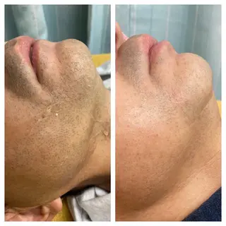 salon   de epilaのエステ・リラクイメージ