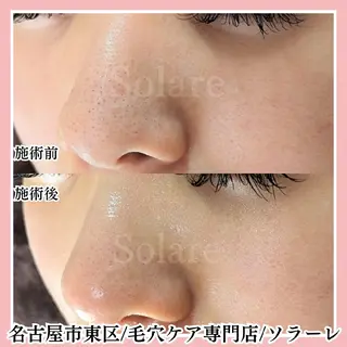  毛穴洗浄・まつ毛 の専門店 ソラーレのエステ・リラクイメージ