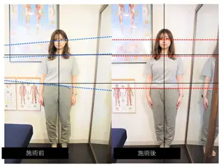 🟢美姿勢／肩こり／ 腰痛／整体師水野🟢のエステ・リラクイメージ