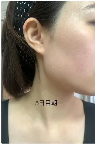 エステティック RAYVIS池袋🐱のエステ・リラクイメージ