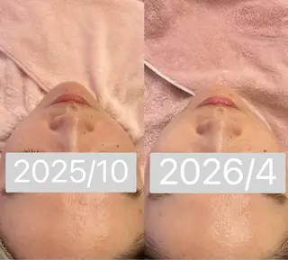 小顔&毛穴・肌質改善 LINDA西宮 AIのエステ・リラクイメージ