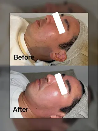 メンズ facial salon D 吉沢のエステ・リラクイメージ