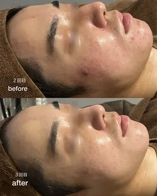 ENCHANT Kaede/肌質改善のその他イメージ