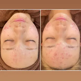 パーソナルスキンケア 🦋APRI🅿️有のエステ・リラクイメージ