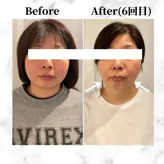 12Dハイフ💗 最強小顔のエステ・リラクイメージ