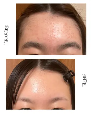 脱毛・肌質改善サロン Linoのエステ・リラクイメージ