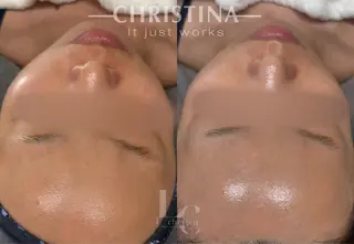 Le cherienのエステ・リラクイメージ