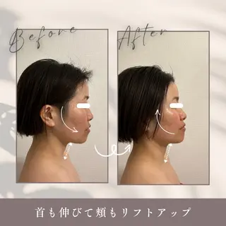 小顔セラピー LILのエステ・リラクイメージ