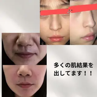 マツエク・マツパ 愛維美水光美肌専門店 メンズレディースokのエステ・リラクイメージ