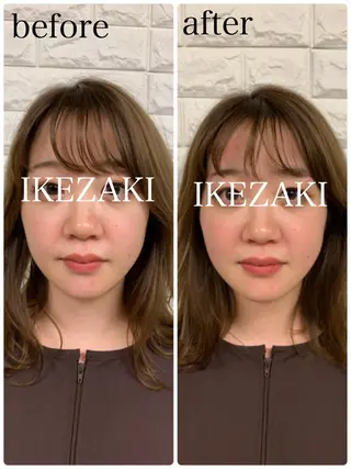 美容鍼 IKEZAKIのエステ・リラクイメージ
