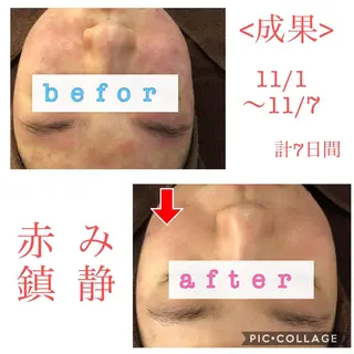 ミディアム カラー パーマ ヘアアレンジ メンズ キッズ ネイル マツエク・マツパ 金の糸脱毛 産毛ケア専門のエステ・リラクイメージ
