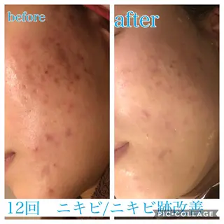 ミディアム カラー パーマ ヘアアレンジ ネイル マツエク・マツパ EnsorClair 代表 野口真央のエステ・リラクイメージ