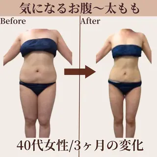 Belle White所属・本格痩身＊透明美肌 BelleWhiteのエステ・リラクイメージ