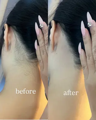 うなじ脱毛/美肌脱毛 LABELのエステ・リラクイメージ