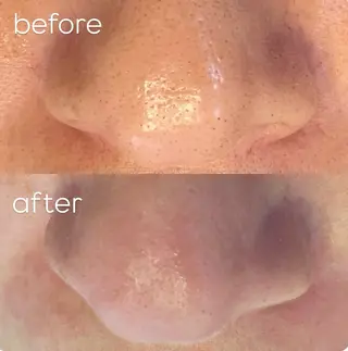 毛穴ケア専門サロン m&uのエステ・リラクイメージ