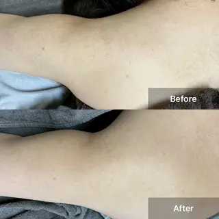 ハーブピーリング 専門店MOKA所属・ハーブピーリング専門 MOKAのエステ・リラクイメージ