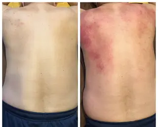 鍼灸院楽々館所属・宇田 碧のエステ・リラクイメージ