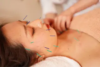 美容鍼・鍼灸専門❤✨ 近藤めぐみのエステ・リラクイメージ