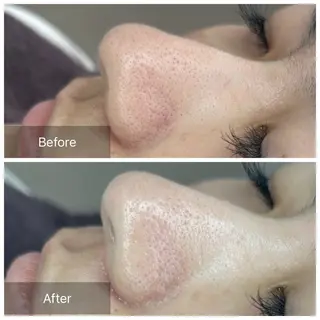 トータルしみケア専門 NICA(ニカ)の眉毛・アイブロウイメージ