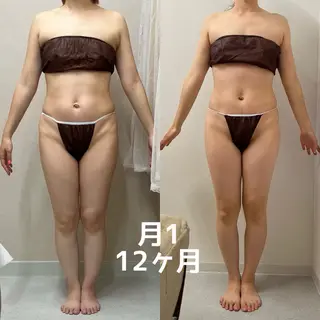 asmy 西梅田店のエステ・リラクイメージ
