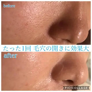 ミディアム カラー パーマ ヘアアレンジ キッズ ネイル マツエク・マツパ EnsorClair 代表 野口真央のエステ・リラクイメージ