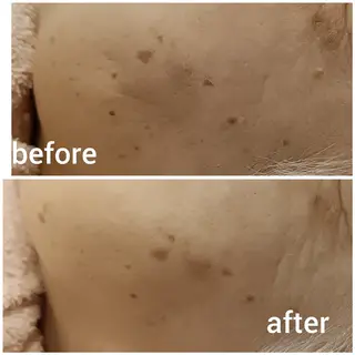 ゼロス｜癒し×小顔 エステ＆耳ツボサロンのエステ・リラクイメージ