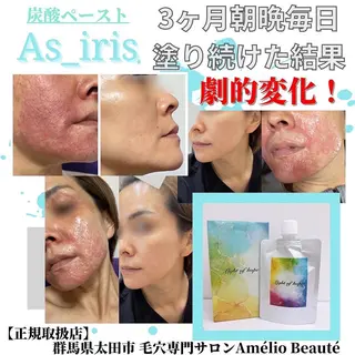 毛穴ケア専門サロン アメリオボーテのその他イメージ